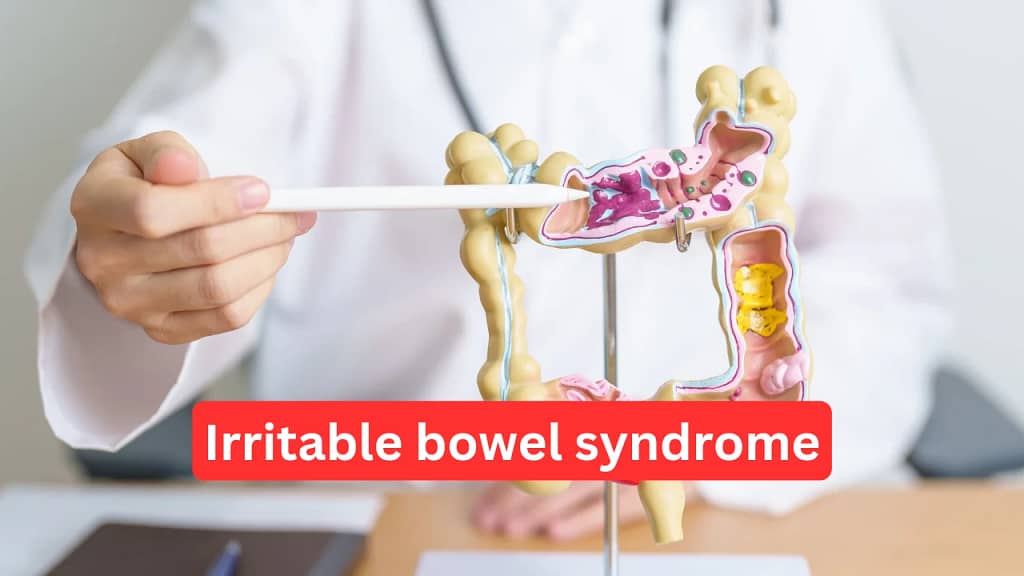 પેટની જમણી બાજુના દુખાવાનું કારણ 6: IBS (Irritable bowel syndrome)